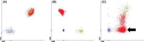 Flow Cytometry Of Bone Marrow Aspirate Gated To Show Mature B
