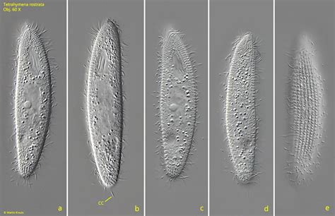 Tetrahymena rostrata – Real Micro Life