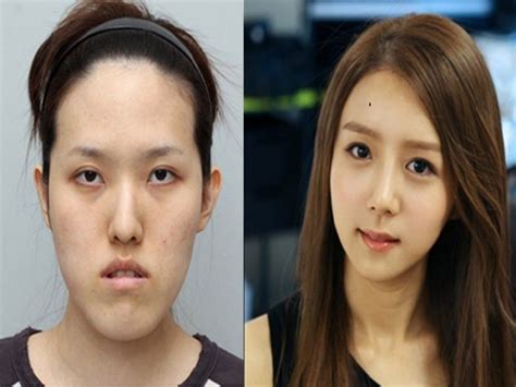 Korean Idols Without Plastic Surgery Korean Idol Plastic Surgery