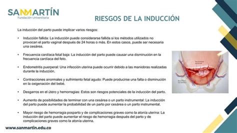 Induccion Y Conduccion Del Trabajo De Parto Pptx