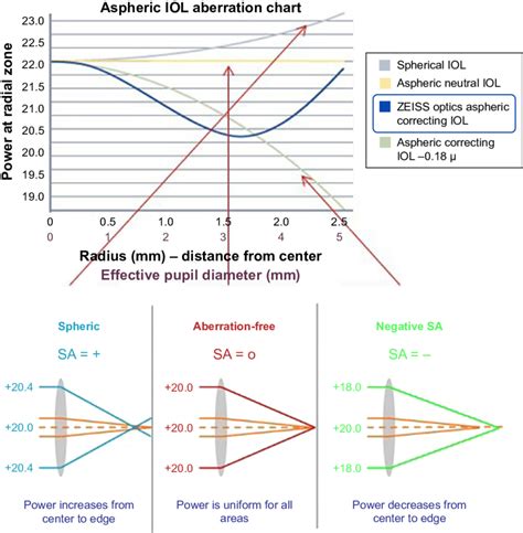 Zeiss Asphericity Concept Zo Combining The Advantages From Negative