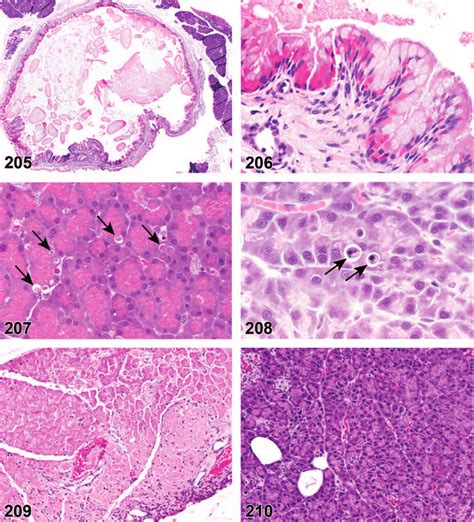 Mouse Pancreas Ectasia Duct With Eosinophilic Globules Figure Download Scientific Diagram