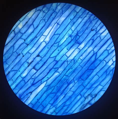 Difference between onion cell and human cheek cell – Artofit