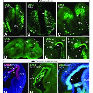 Photomicrographs Of Transverse Sections Through The Telencephalon Of