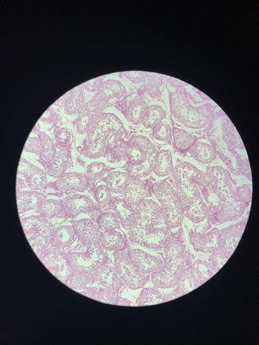 Male Reproduction Histology Flashcards Quizlet