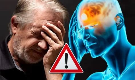 Cluster Headache Causes Symptoms And Treatment Diseases And Conditions 2024