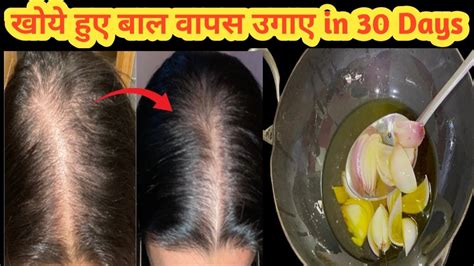 30 Days Extreme Hair Growth Challenge Most Powerful Oil To Grow Hair