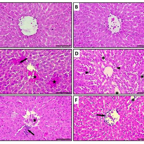 Histopathological Evaluation Of Liver Tissues A Normal Liver Download Scientific Diagram