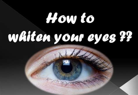 Get Whiter Eye Whites With These 7 Exclusive Tips White Eyes Eyes