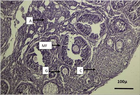 Cross Section In Weeks Old Control Ovary Mature Follicles Mf Growing