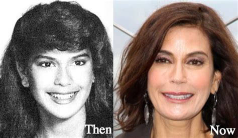 Teri Hatcher Plastic Surgery Before and After Photos