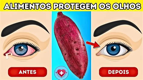 Descubra Os Alimentos Que Protegem Seus Olhos E Reparam Sua Vis O