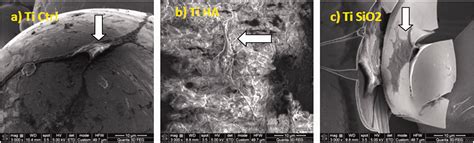 Current Methods Of Preventing Aseptic Loosening And Improving Osseointegration Of Titanium