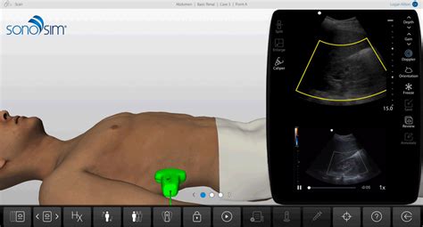 Abdomen Ultrasound Training