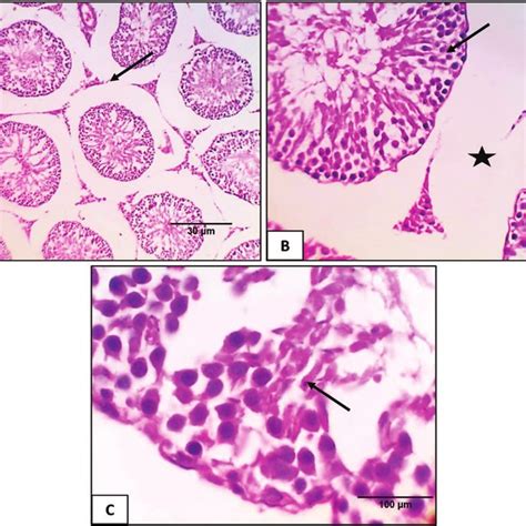 Sections From Testicular Tissue A Control Group Showing Normal