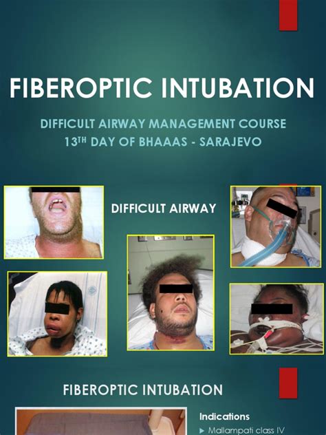 Fiberoptic Intubation | PDF | Human Anatomy | Respiratory System