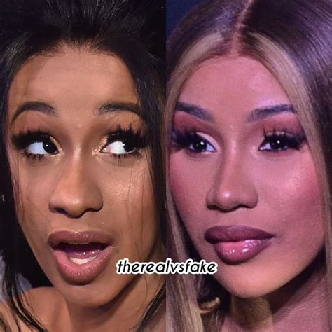 Cardi B Before And After Nose Job And Fillers Celebrity Plastic Surgery