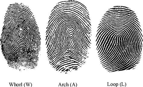 Dermatoglyphic Patterns On Fingers And Gynecological Cancers European Journal Of Obstetrics