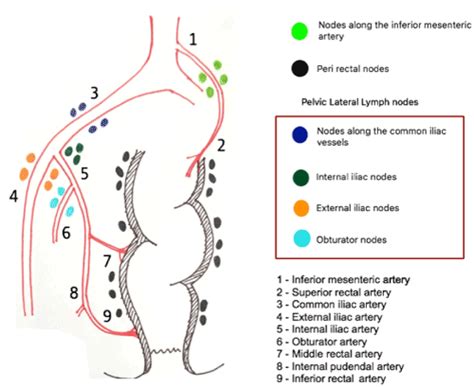 Normal Para Aortic Lymph Node Size Images