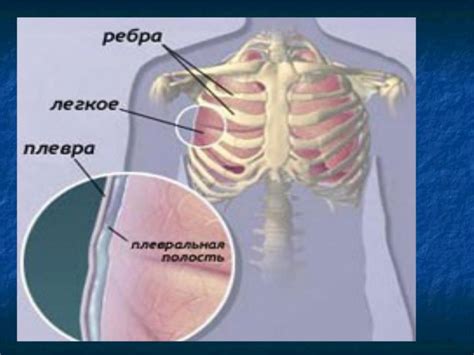 Презентация на тему: ПЛЕВРИТЫ