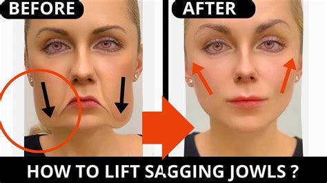 Face Lifting Exercises For Jowls Laugh Lines Nasolabial Folds