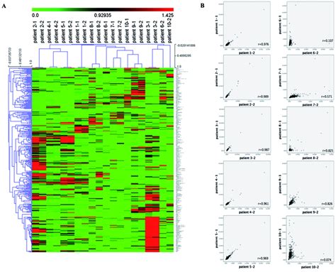 The Overall Metabolomics Profile Of RAML Patients Before And Post