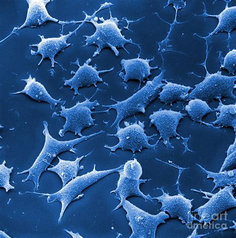 Human Fibroblast Cells Photograph By David M Phillips Fine Art America