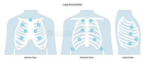 Listen Lung Sounds Stock Illustrations – 15 Listen Lung Sounds Stock ...