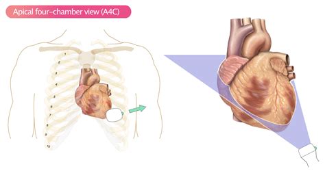 Echocardiographie Transthoracique Standard Protocole D Imagerie