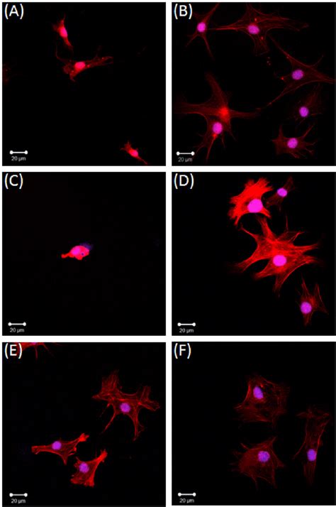 8 Integrin Mediated Cell Spreading Phalloidin Staining Of Bovine