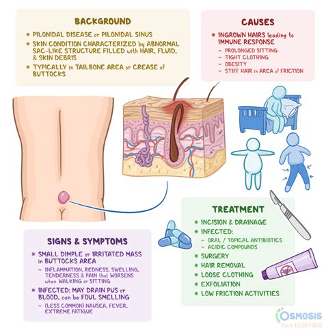 Pilonidal Sinus