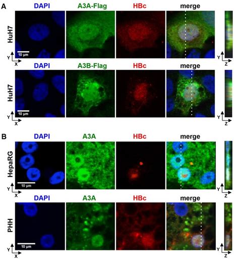 Co Localization Of A3A And A3B With HBV Core Protein HBc A HuH7