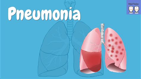 Pneumonia Overview Pathophysiology Community Vs Hospital Acquired