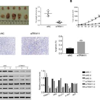 Sitrim Suppressed The Tumorigenicity Of Breast Cancer Cells In Nude