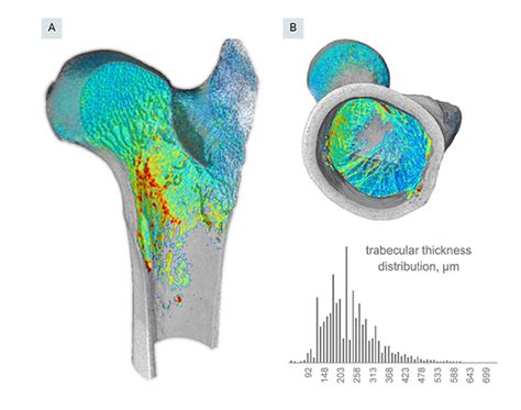 Tescan Unitom Xl D Micro Ct Analysis Of A Sheep Femur Tescan