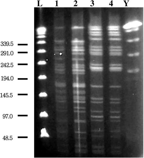 Pulsed Field Gel Electrophoresis Typing Of Four Pseudomonas Aeruginosa