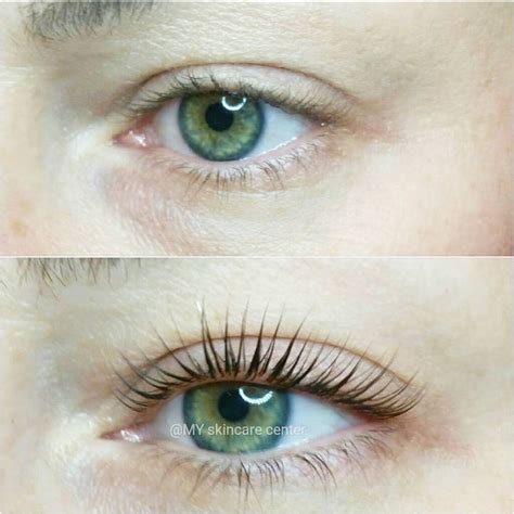 Lash lift & Tint before & after pics bergen county NJ