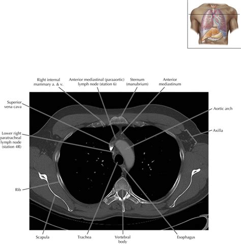 Thoracic Lymph Nodes