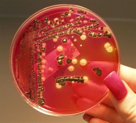 Salmonellae growing on XLD Agar | Medical Laboratories