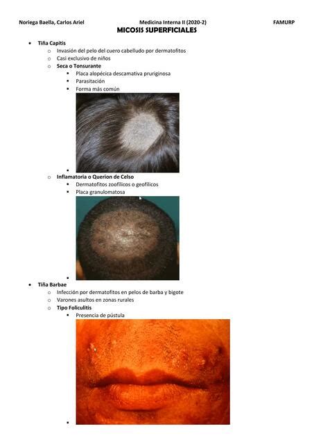 Micosis Superficiales Carlos Ariel Noriega Baella Udocz