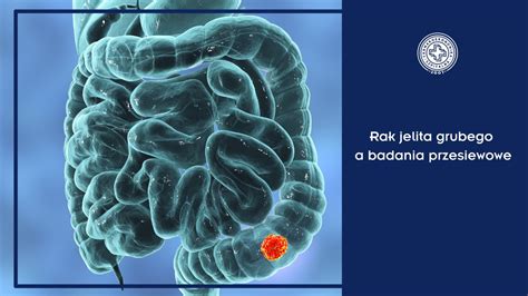 Rak Jelita Grubego A Badania Przesiewowe Farmakoekonomika