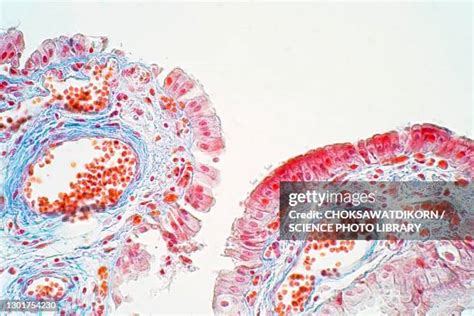 107 Simple Columnar Epithelium Stock Photos High Res Pictures And