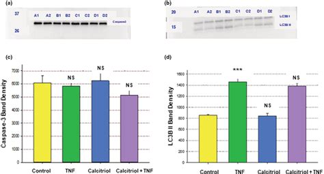 Effect Of Tnf And Calcitriol On Hbe Caspase And Lc B Levels