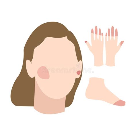 Hipotermia De La Mano Doodle Icono Mano Dibujado Ilustración