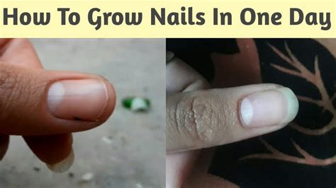 How To Grow Nails In One Day Grow Nails FAST LONG NAILS In 1 Day