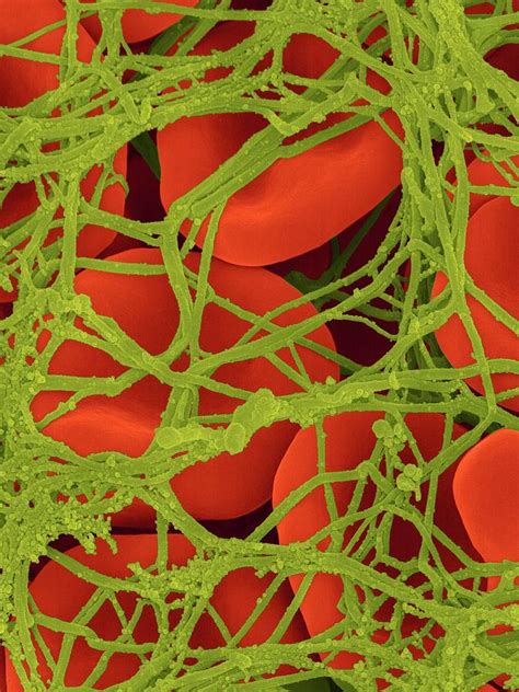 Blood Clot Photograph by Dennis Kunkel Microscopy/science Photo Library