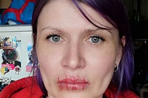 Russian Woman Sews Her Mouth Shut To Protest Putins Anti War Censorship The Zambian Observer