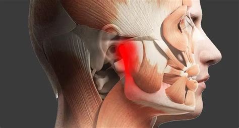 Articulación Temporomandibular ATM y el Dolor Temporomandibular DTM