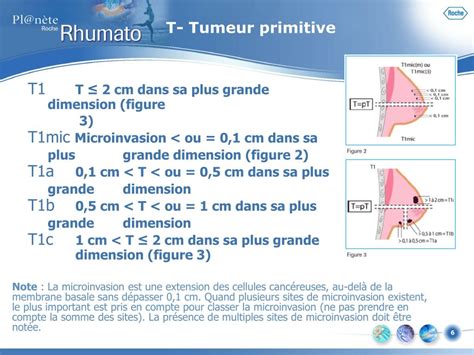 Ppt Classification Tnm Illustrée Powerpoint Presentation Free