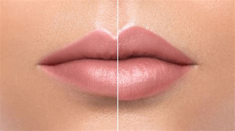 Quanto Tempo Dura O Preenchimento Labial Descubra Aqui Beleza 360